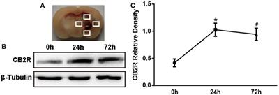 Inflammatory Regulation by Driving Microglial M2 Polarization: Neuroprotective Effects of Cannabinoid Receptor-2 Activation in Intracerebral Hemorrhage